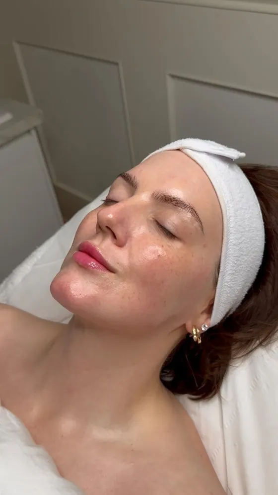 Dewy, lifted skin after a CACI facial at The Self-Care Clinic